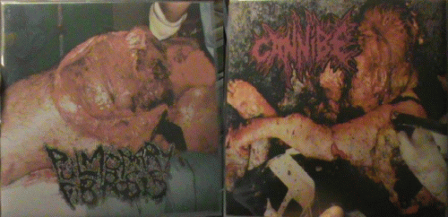 Cannibe : Cannibe - Pulmonary Fibrosis